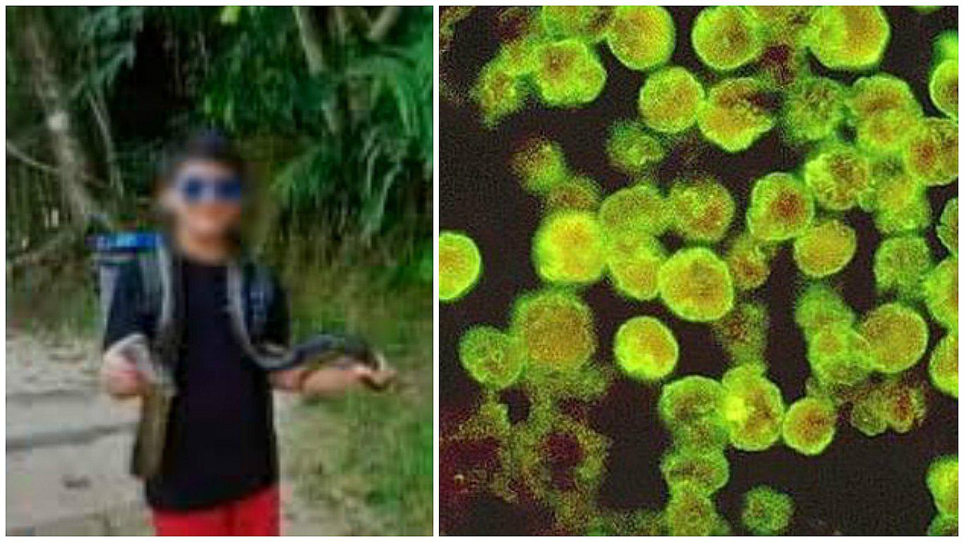 Ameba "come cerebros": estos son los síntomas de enfermedad que ya mató a 4 niños en el Perú