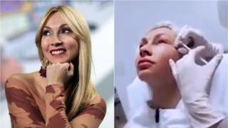 Belén Estévez se inyectó botox cerca a los ojos porque detectó arrugas (VIDEO)