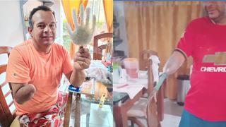 Hombre que perdió brazo se hace una prótesis de botella de plástico para salir adelante (VIDEO)