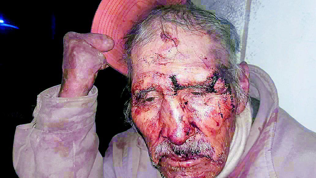 Agreden a anciano por líos judiciales en distrito de San Miguel - Juliaca