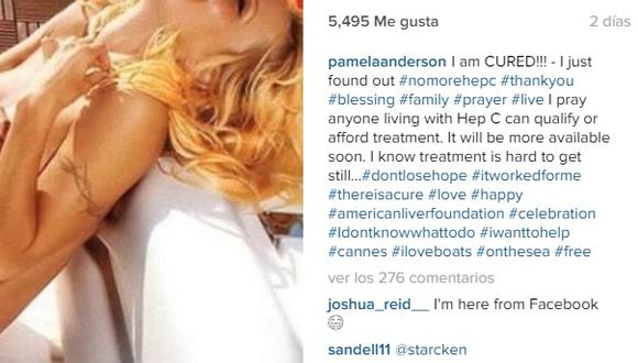  Instagram: Pamela Anderson se desnudó para celebrar que se curó de grave enfermedad [FOTO]