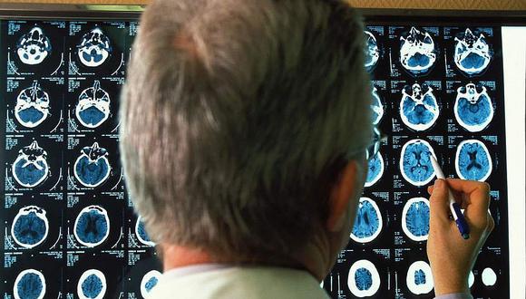 Alzheimer: Una hormona abre una nueva esperanza para tratar esta enfermedad