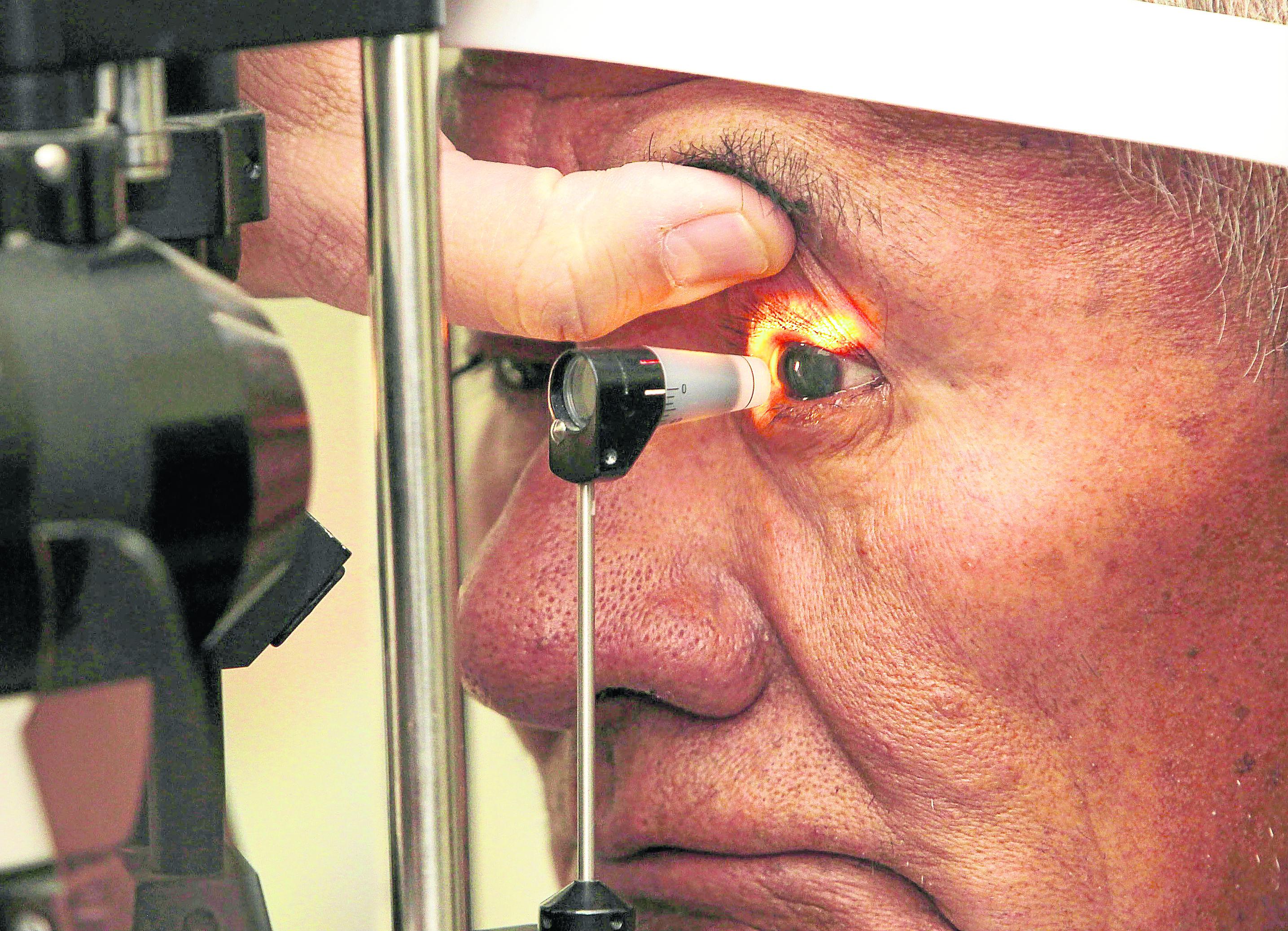 ​Casos de cataratas y carnosidad aumentan por  rayos UV