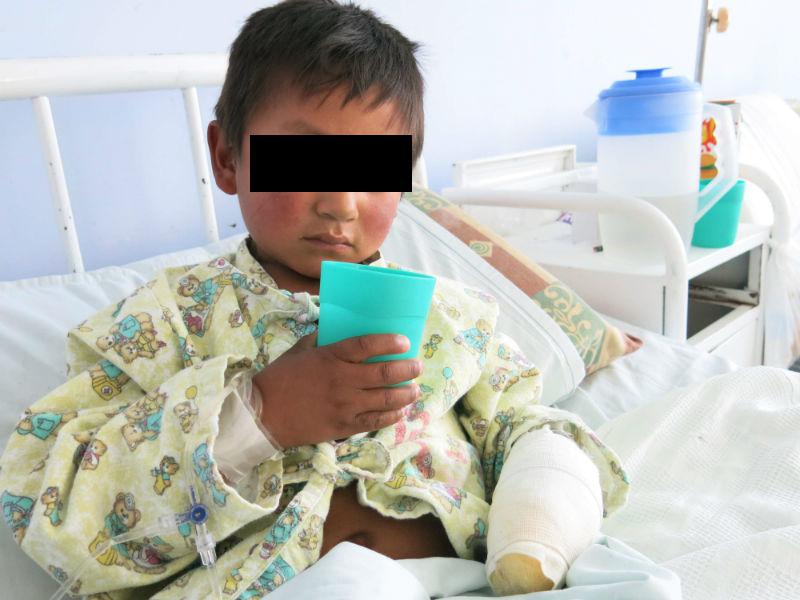 Pirotécnico dejado en enfrentamiento  le vuela los dedos a menor 