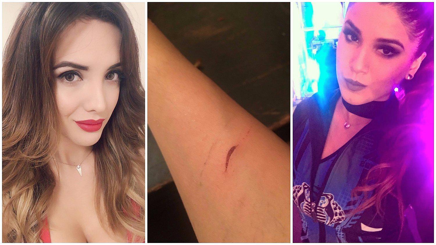 Yahaira Plasencia mandó duro mensaje a Rosángela Espinoza por mostrar marcas en su brazo