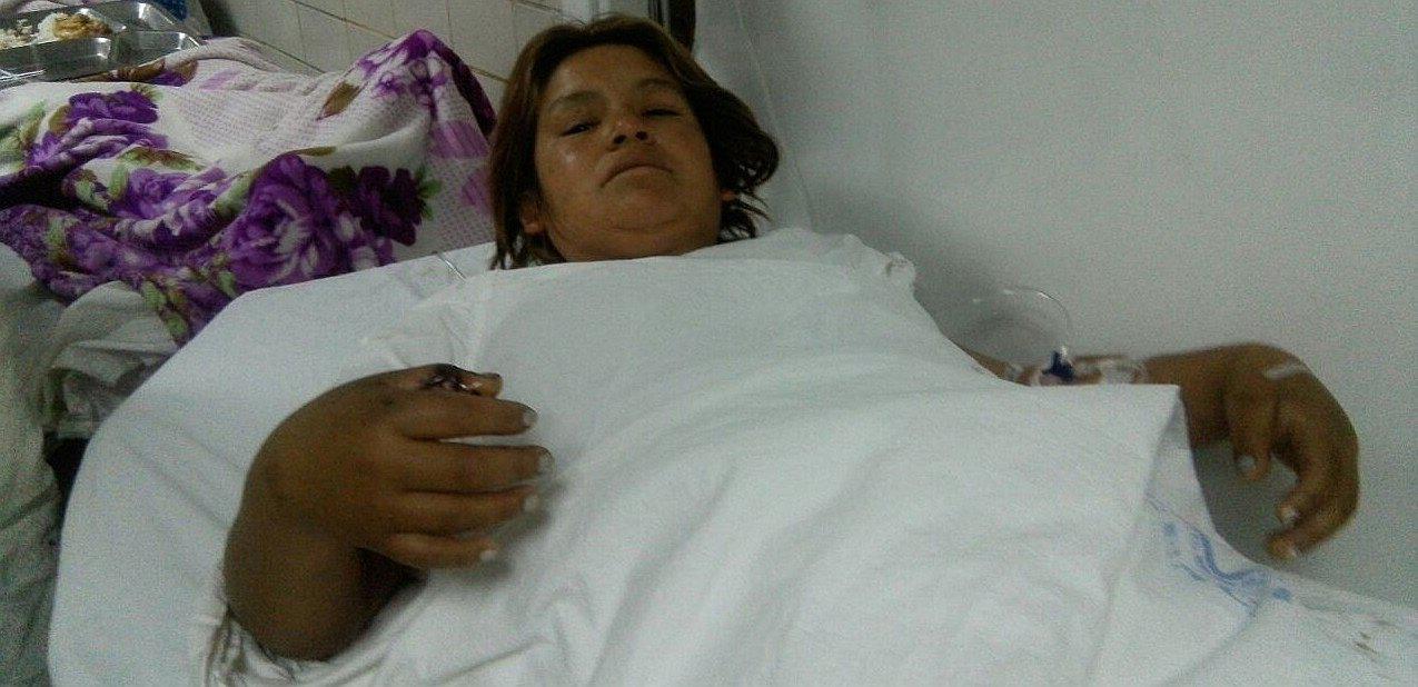 Trujillo: Mujer es agredida por su expareja a ladrillazos 
