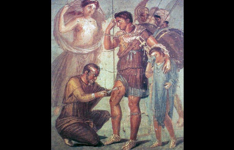 ¿Qué técnicas usaban los antiguos romanos para aliviar el dolor?