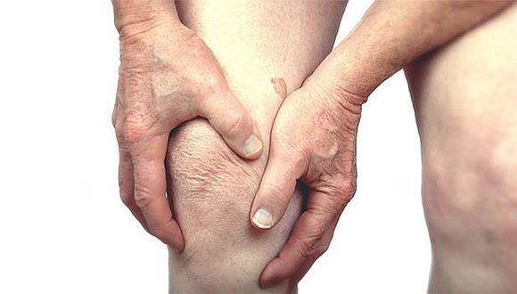 ​Artritis reumatoide puede manifestarse por estrés y llega a ser mortal