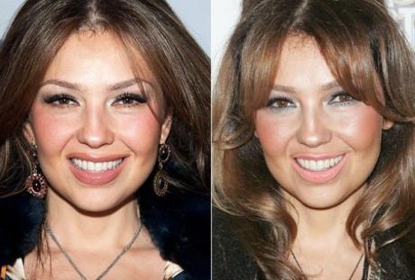 ¿Qué le pasó a Thalía en la cara?
