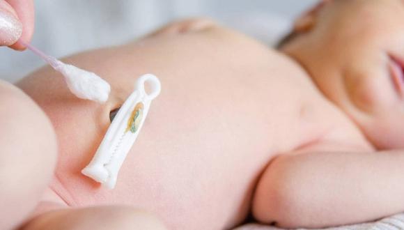 Preparativos para la llegada de tu bebé: ¿Qué es el 'clampaje' y cuál es su importancia?