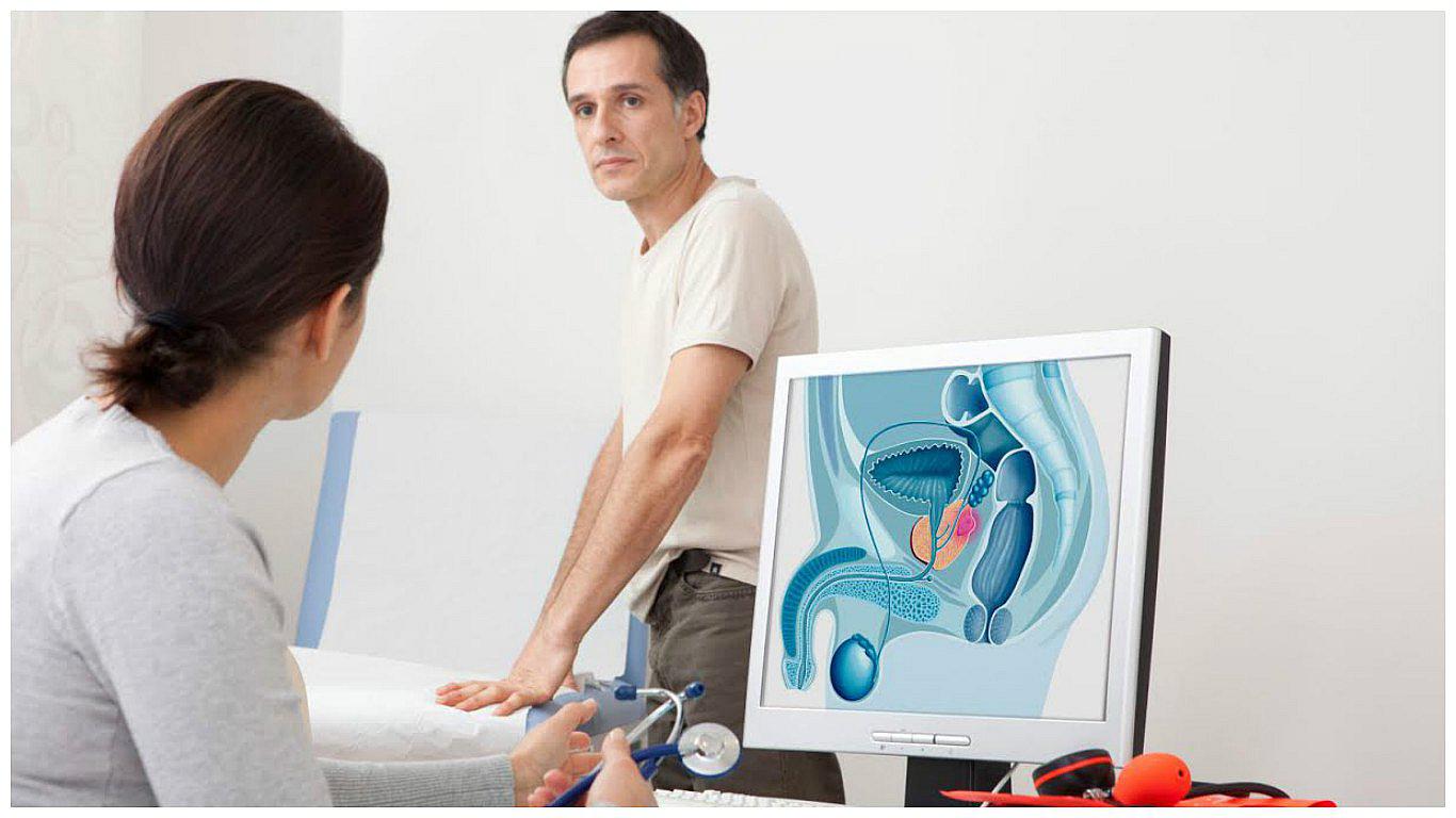 T​emor a examen de próstata aumenta posibilidad de padecer cáncer