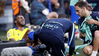 Real Madrid: la imagen de Carlos Akapo tras la lesión que Eden Hazard cometió sobre el jugador de Cádiz