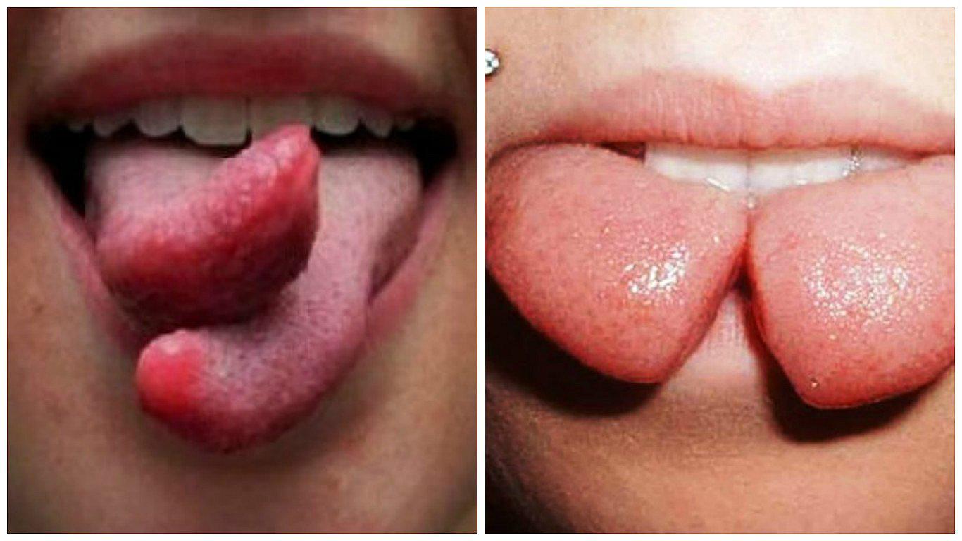 Lengua bífida: conoce los riesgos de esta moda mundial