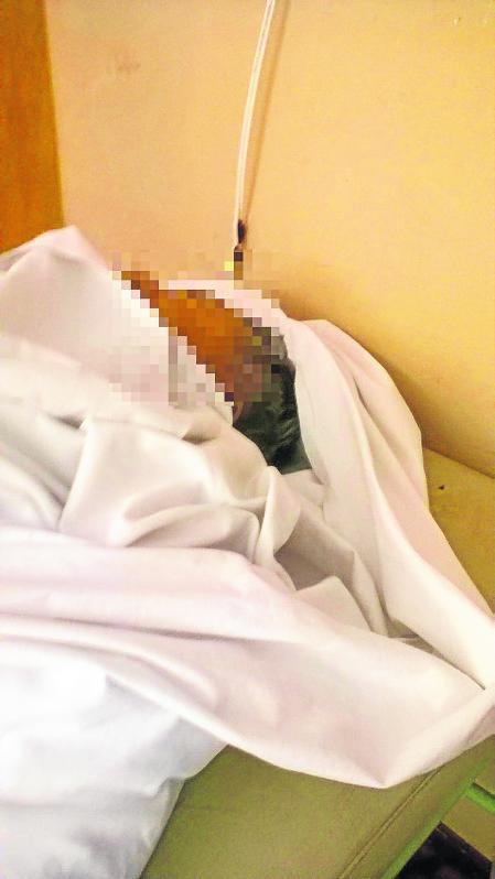 Muere en el hospital a causa de terribles golpes