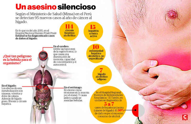 ​163 pacientes con cirrosis hepática en EsSalud