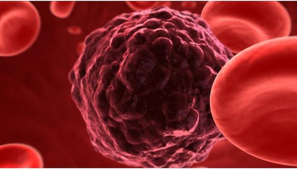Cáncer: Una terapia genética sería la clave contra la leucemia