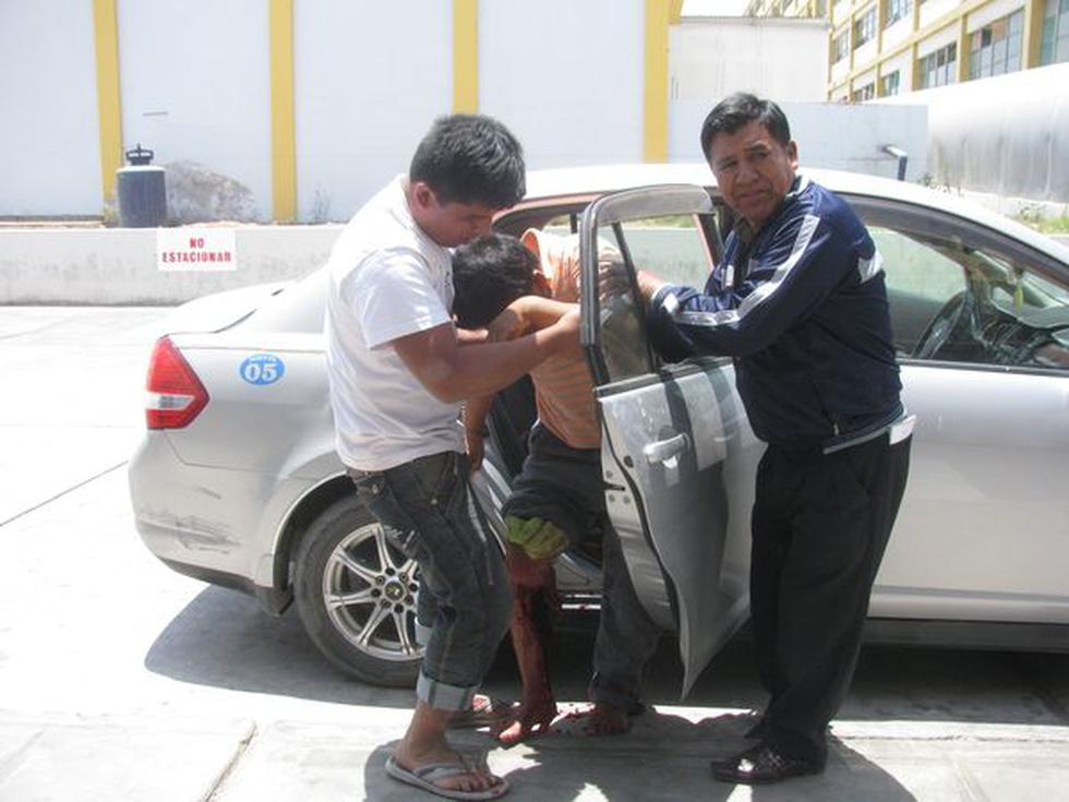 Obrero se corta la pierna con sierra eléctrica