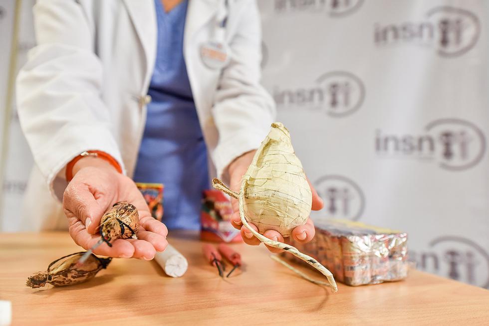 Cifra de niños quemados aumenta en un 30% durante Navidad