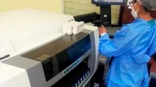 Nueva tecnología para banco de sangre de hospital de Juliaca