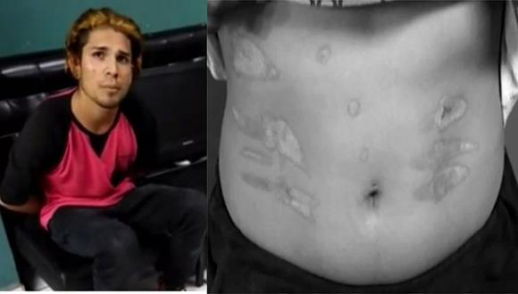 Venezolano 'castigó' a su pareja quemando su cuerpo con un soldador eléctrico (VIDEO)