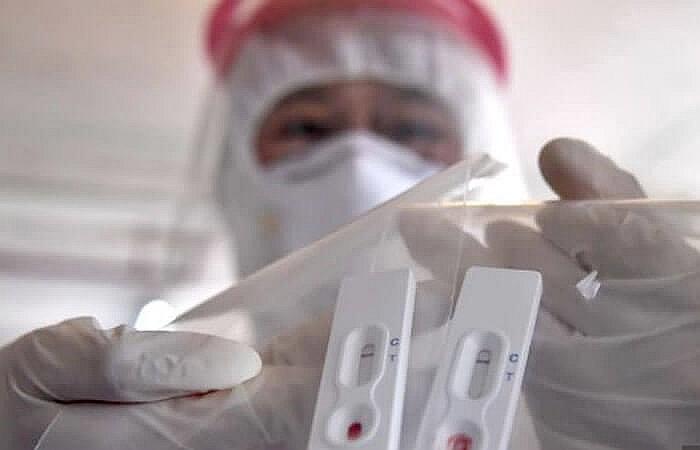 Pruebas rápidas (Foto: Archivo)