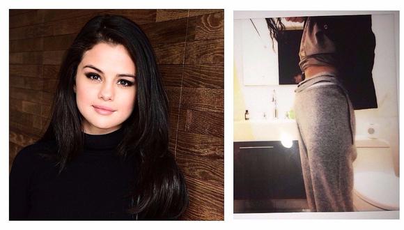 Selena Gomez: ¿tiene cura la enfermedad que padece la cantante?