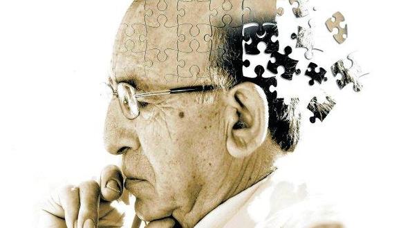 El Alzheimer es una enfermedad que cada vez se presenta a una edad más temprana. (Foto: Difusión)