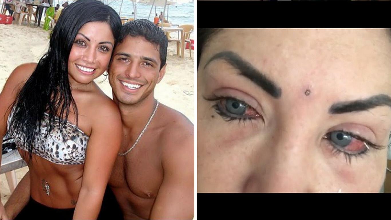 Modelo argentina se operó los ojos para cambiarlos de color y luego se arrepiente (FOTOS)