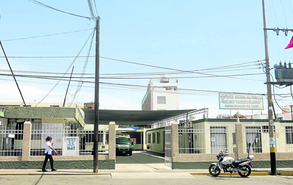 Tacna: nuevo tópico de la policía genera malestar en cuerpo de policías