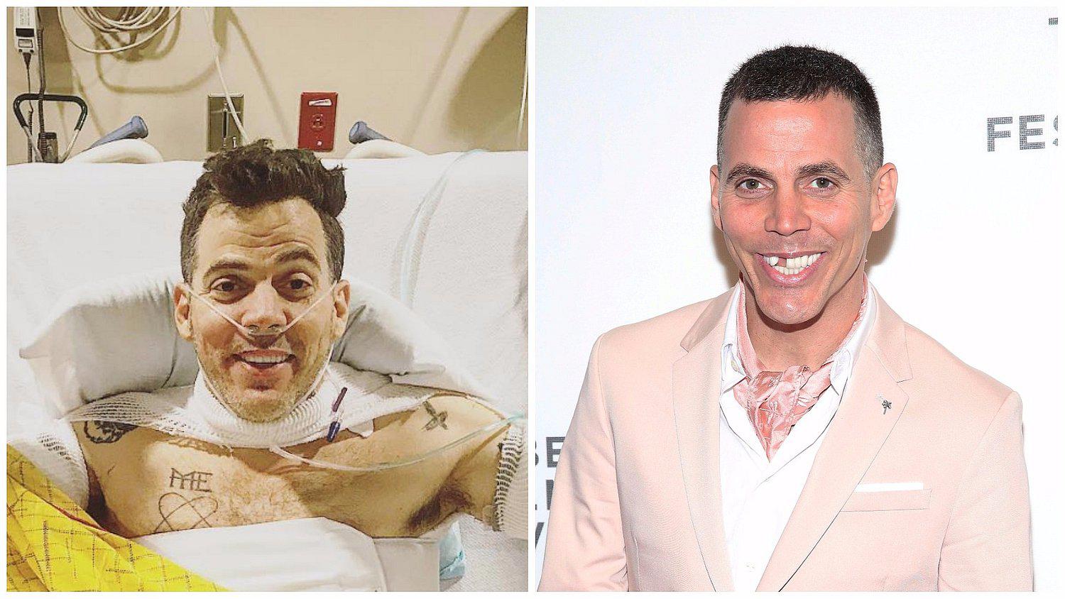 Jackass: exintegrante se quema los brazos y lo comparte en Instagram (VIDEO)