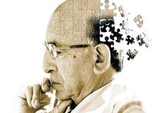 Día Mundial del Alzheimer: ¿Cuáles son los primeros signos de alerta de esta enfermedad?