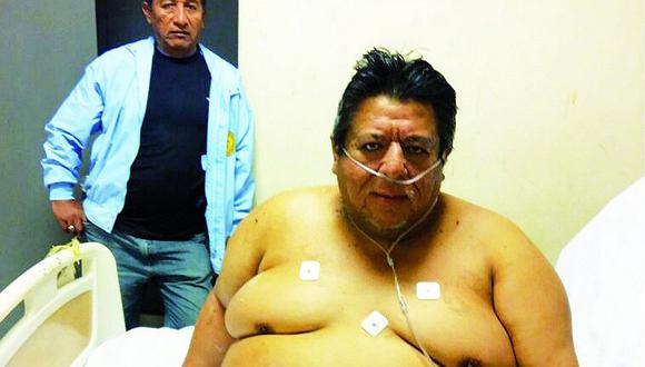 El hombre más obeso del Perú se encuentra en Tumbes