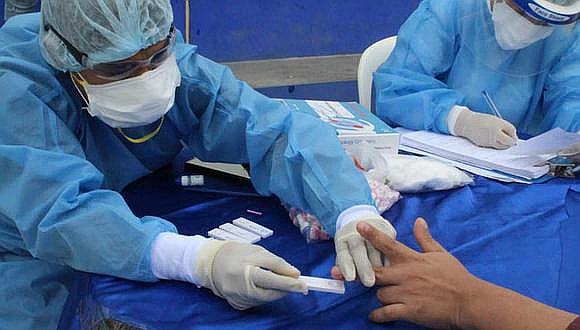 Coronavirus en Perú: entregan 5000 pruebas rápidas a la Diresa Cajamarca (Foto referencial).