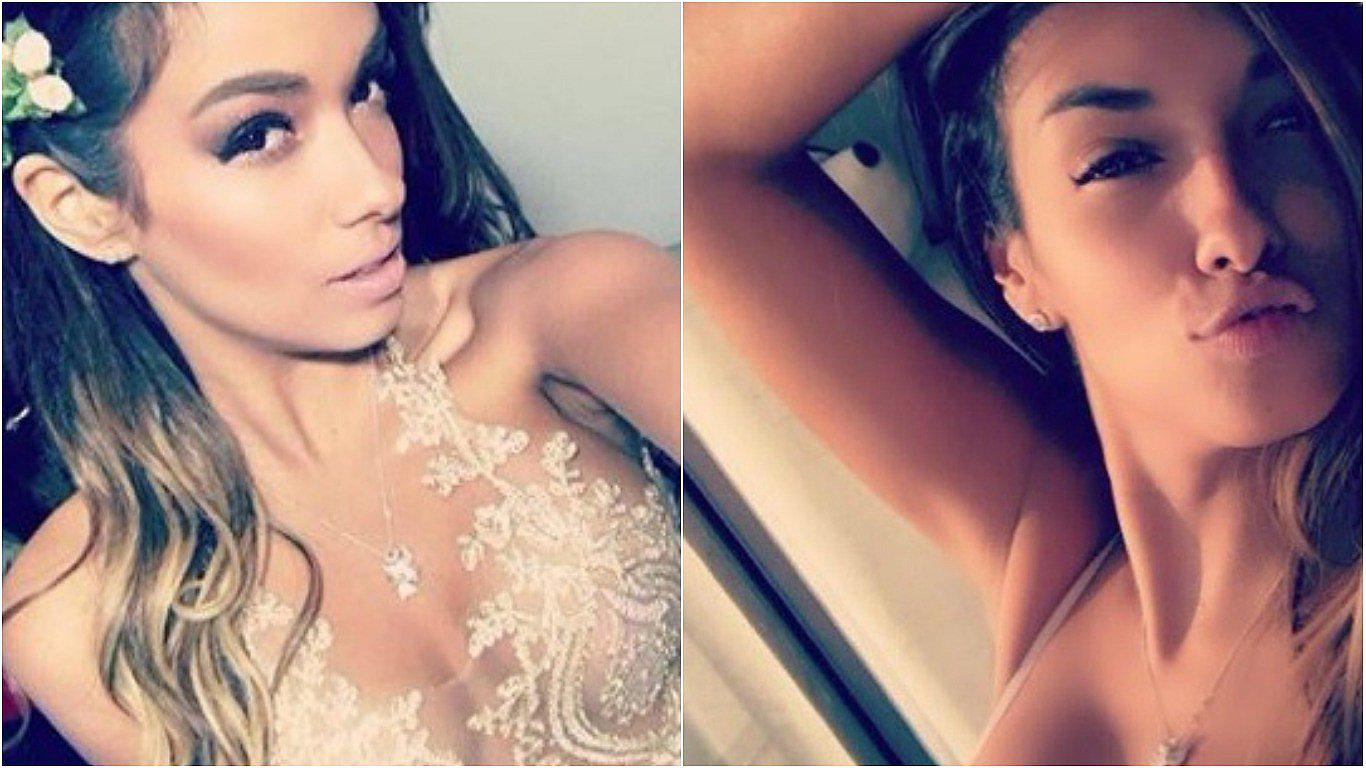 ​Denuncian mala praxis contra Shirley Arica en operación a la clavícula 