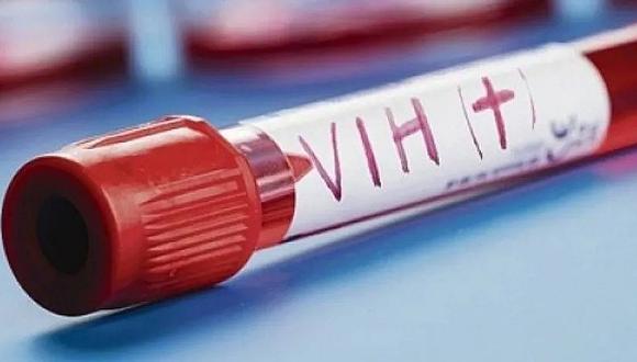 Paciente con VIH sin rastro del virus gracias a trasplante de células madre