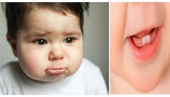 ​¿Cómo aliviar el dolor de encías de tu bebé cuando le comienza a salir un diente? (FOTOS)