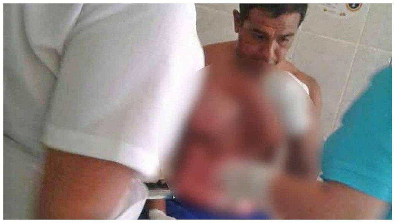 Piura: Un hombre arde en llamas