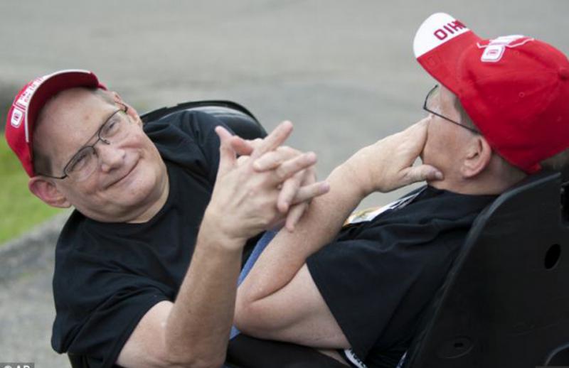 Ronnie y Donnie a punto de ser los siameses más longevos del mundo