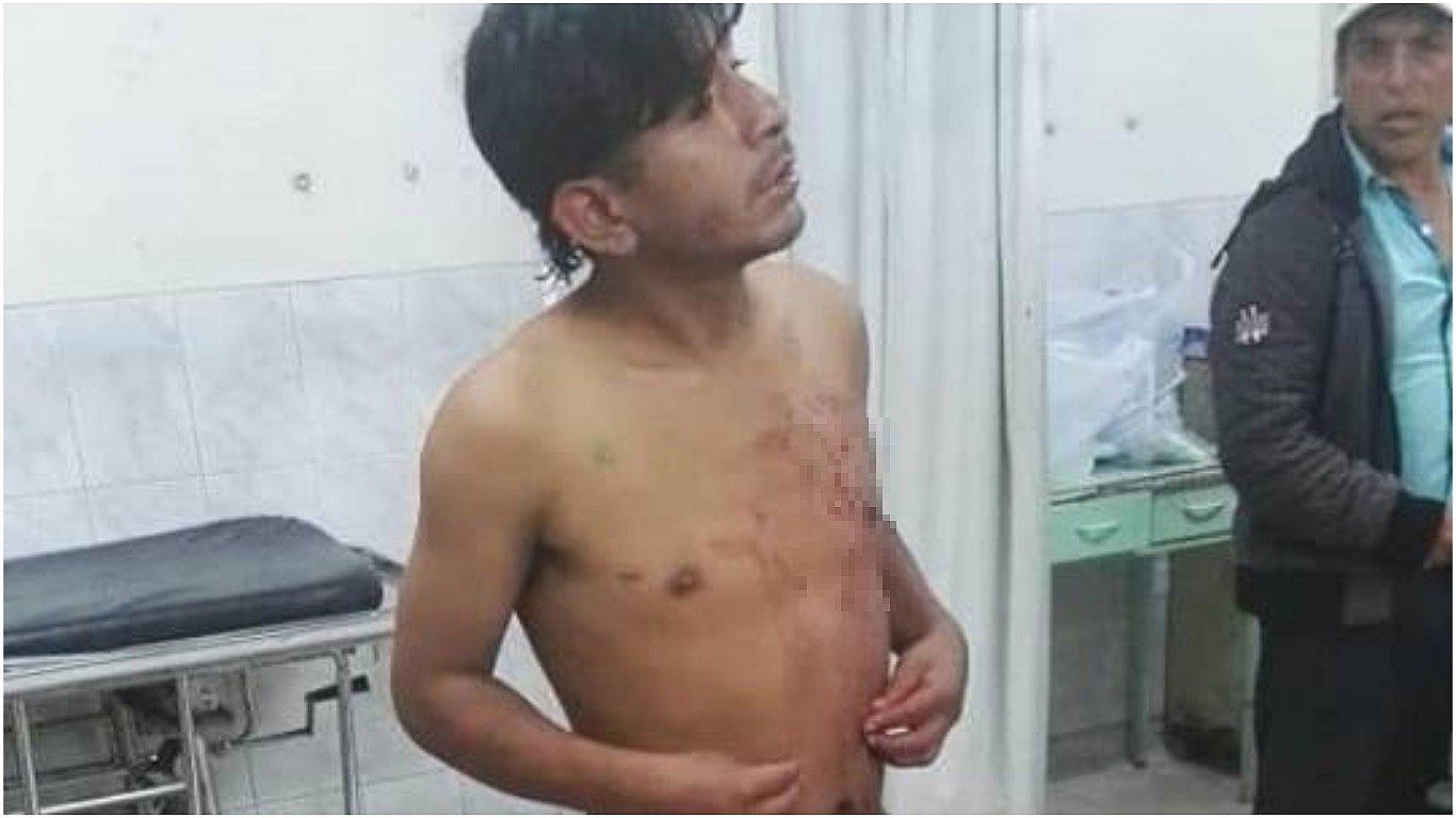 Hombre acusa a su pareja de atacarlo con cuchillo tras discusión (VIDEO)