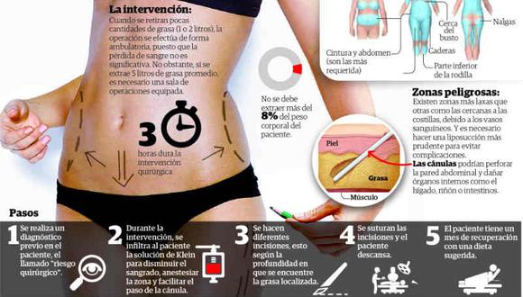 En Huancayo a la semana 15 mujeres se someten a una liposucción