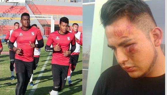 Jugadores del FBC Melgar son denunciados por agredir a un universitario