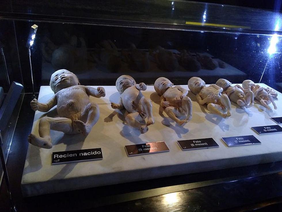 Exhibición de cuerpos reales en Arequipa (VIDEO)