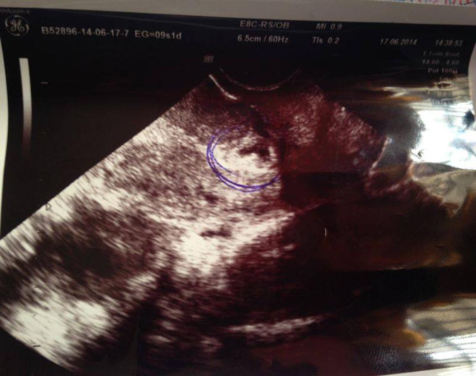 Corazón Serrano: Yrma Guerrero anuncia embarazo y que se aleja de agrupación (Fotos)