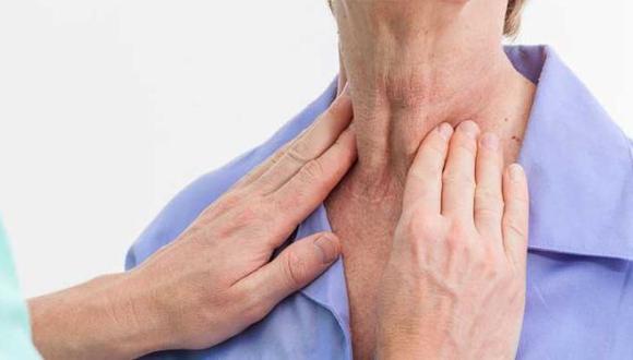 La especialista señala que la principal alteración tiroidea es el hipotiroidismo, que se caracteriza por la baja o nula actividad de la glándula.  (Difusión)