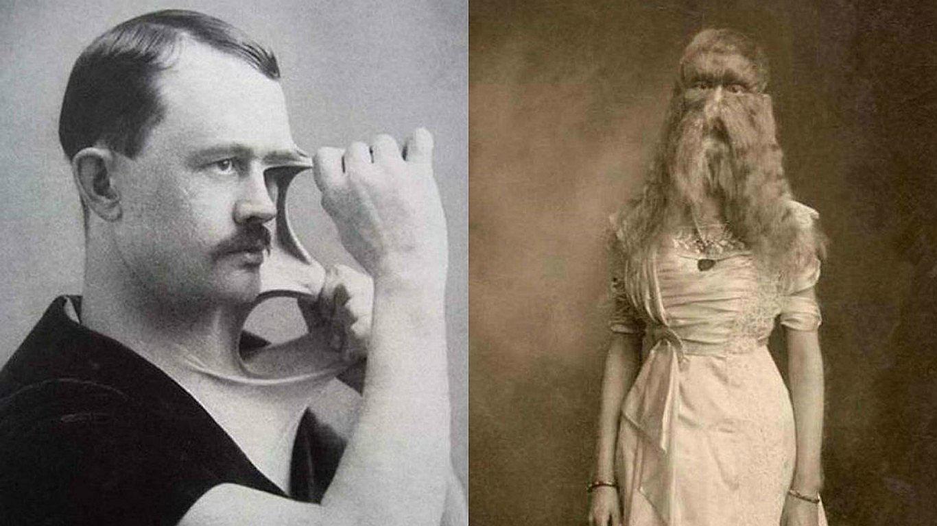 ​Circo de la antigüedad: conoce a sus personajes más extraños [FOTOS]
