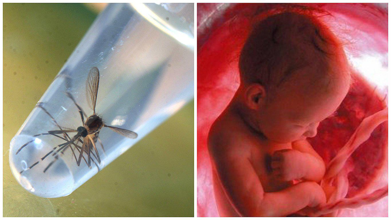 Zika: La presencia de virus en suero materno sí infecta al feto