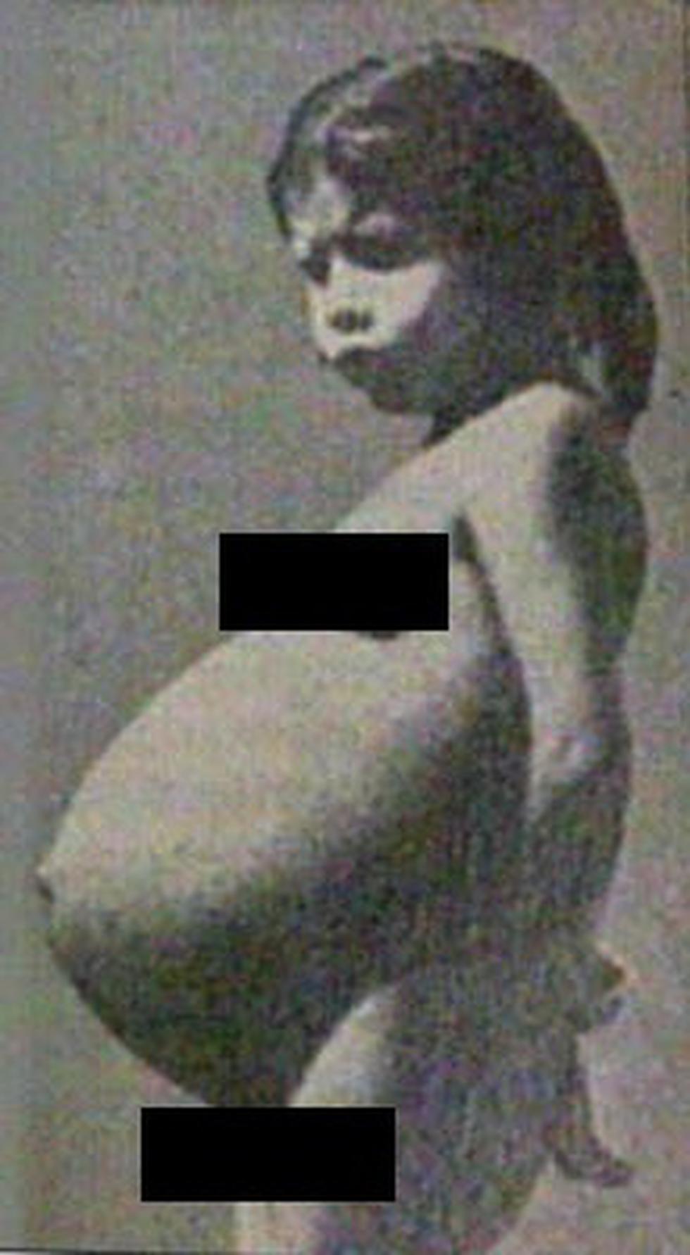 Recuerde a Lina Medina, la madre más joven de la historia de la medicina 