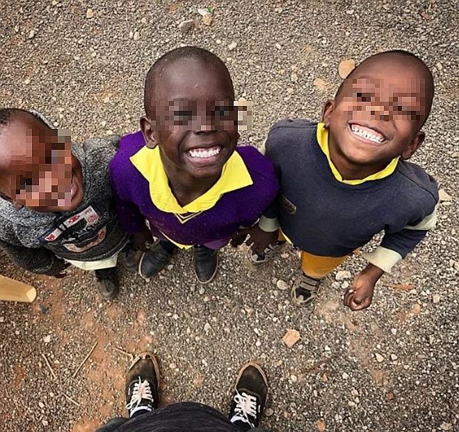 Felipe Rossi, el dentista que recorre el mundo reparando sonrisas a personas de bajos recursos