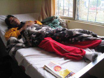 Pescador pierde los dedos con explosivo