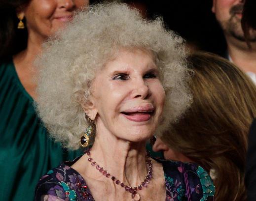 Duquesa de Alba en reposo obligado tras sufrir accidente